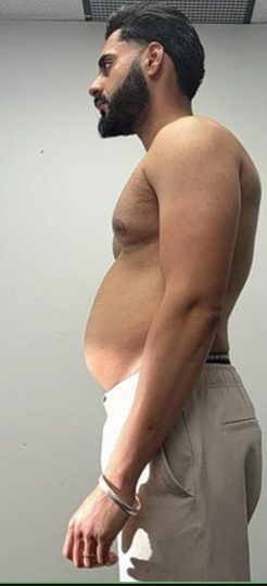 Danny H. before starting coaching with HupsFit