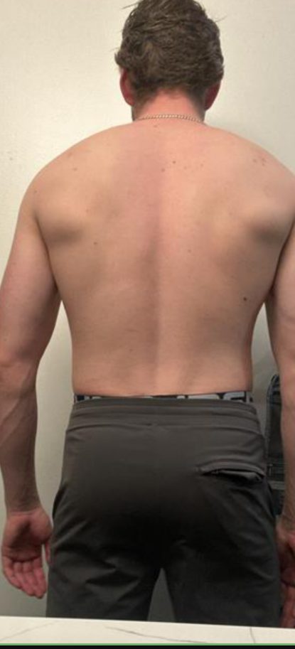 Justin W. before starting coaching with HupsFit