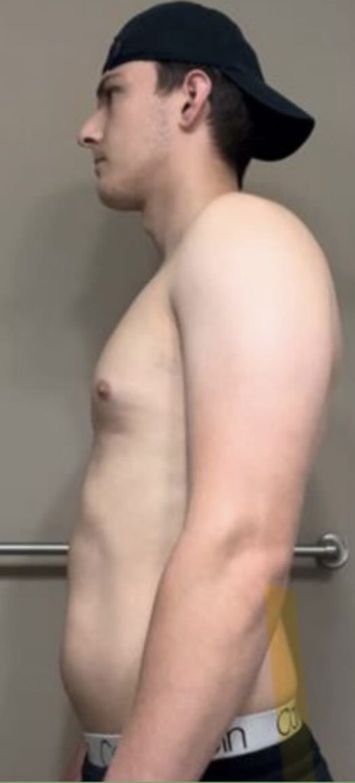 Ryan O. before starting coaching with HupsFit